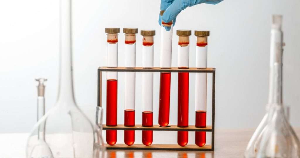 what is a test tube rack used for